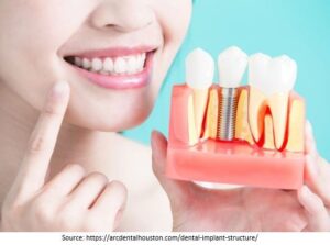 Dental Implant Treatment