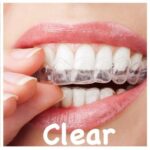 Invisible braces image